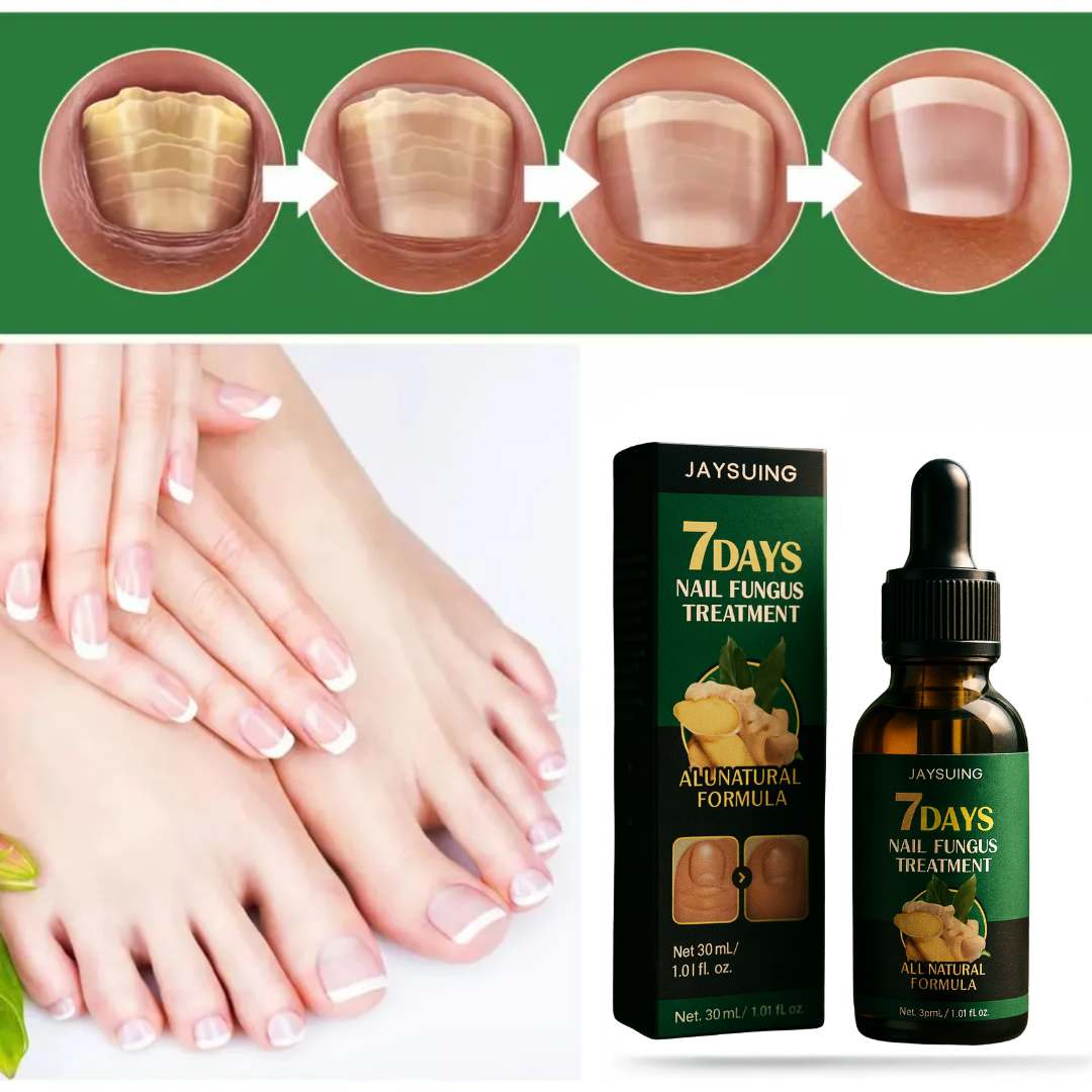 Tratamiento de hongos para uñas 7 Days® Nail Fungus Treatment 2x1